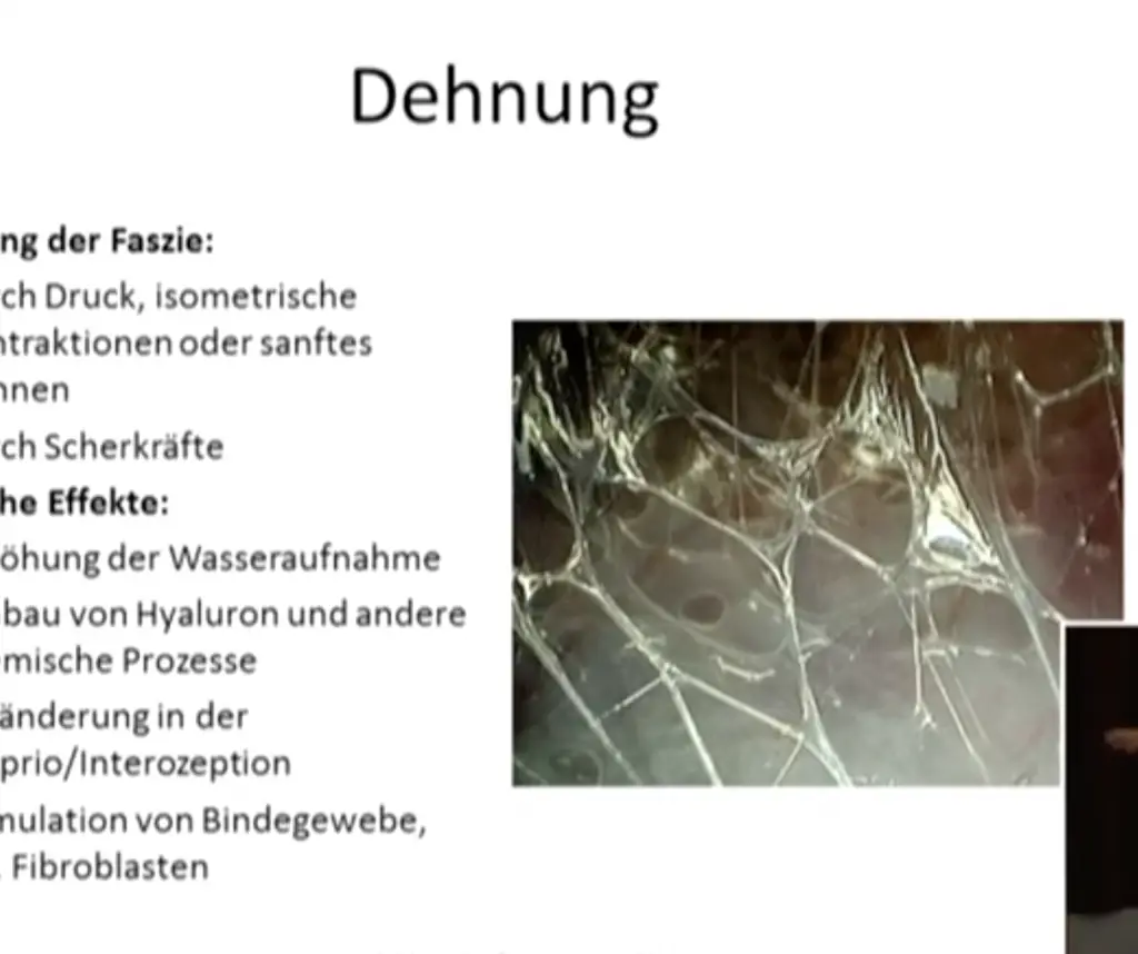 Dehnung